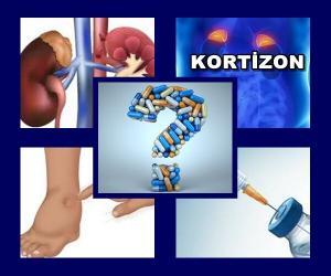 Kortizon Tedavisinde  Ödem Neden Oluşur ?