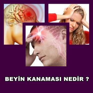 Beyin Kanaması Nedir?