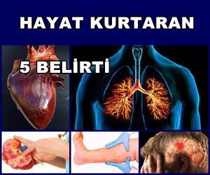 Hayat Kurtaran 5 Belirti Nelerdir?
