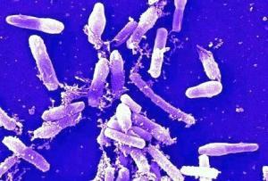 Bacillus Cereus Zehirlenmesi Nasıl Oluşur?