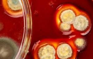 Bacillus Cereus Zehirlenmesi Nasıl Oluşur?