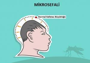 Zika Ateşi Hastalığı Nedir?