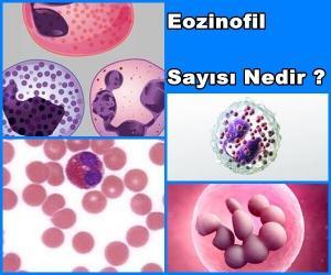 Eozinofil Sayısı Nedir?