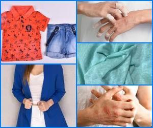 Kumaş Alerjisi  Nedir ? Nasıl Anlaşılır ?