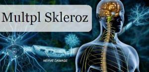 Multipl Skleroz İçin Önerilen Besin ve Bitkisel İçerikli Takviyeler Nelerdir?