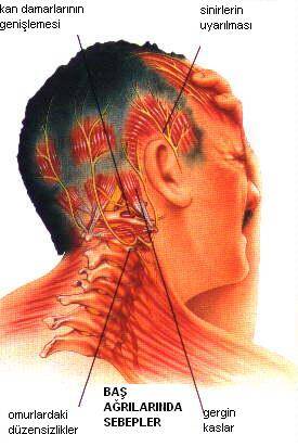 tansiyon belirtileri baş ağrısı yüksek tansiyon sınıflandırma tedavisi