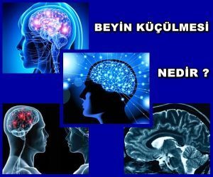 Beyin Neden Küçülür ve Nasıl Önlem Alınır?