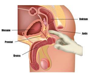 Prostat Sınavı İçin Önerilen Yaş Nedir?