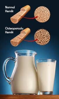 Süt Tüketimi ve Osteoporoz İlişkisi