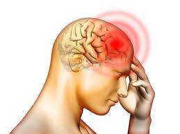 Migren ve Baş Ağrısı Arasındaki Fark Nedir? Baş Ağrısı Çeşitleri