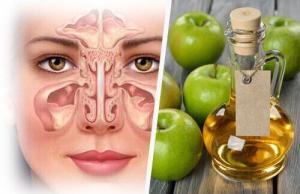 Pansinüzit Nedir? Belirtileri ve Tedavi Yolları Nelerdir?
