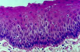 Metaplazi Hücre  ve İntestinal Metaplazi  Nedir ?