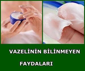 Vazelinin Bilinmeyen Faydaları