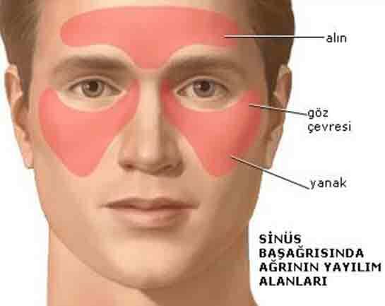 Baş Ağrısının Tedavisinde Basınç ve Masaj Noktaları Nerelerdir?