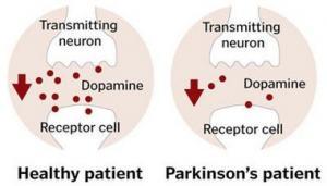 Parkinson Hastalığına Neden Olan Molek&uuml;ler Mekanizmalar