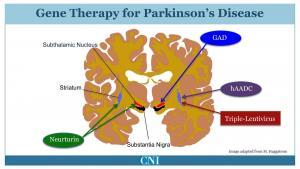 Parkinson Hastalığı İ&ccedil;in Deneysel Tedavi Y&ouml;ntemleri
