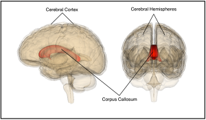 Corpus Callosum’un İşlevi ve İlişkili Hastalıklar