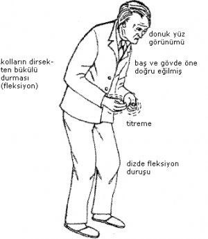 Sindirim Sistemi ve Parkinson Hastalığı: Olası Bir Bağlantı