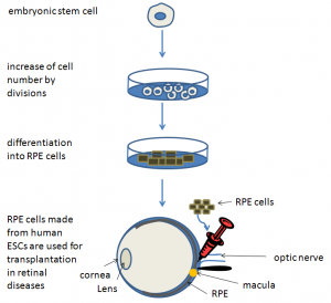 Retinal Hastalıklar İçin Kök Hücre Uygulamaları
