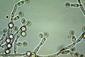 Candida Albicans'ın Sebep Olduğu Hastalıklar