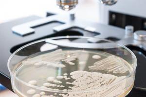 Candida Albicans'ın Sebep Olduğu Hastalıklar
