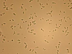 Candida Albicans'ın Sebep Olduğu Hastalıklar