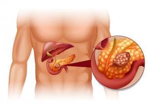 Bir Endokrin Organ Olarak Pankreas