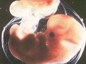 İnsan Embriyosunun Gelişmesi