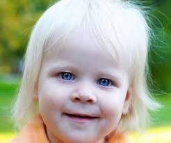 Angelman Sendromu Nedir?