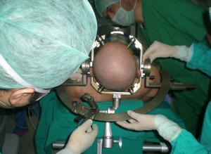 Beynin Frontal Lobunun Yapısı, Fonksiyonları ve Hasarları
