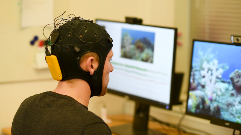 EEG (Elektroensefalografi) Nedir ve Nasıl Çalışır?