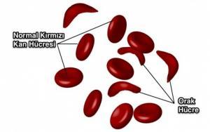 Pleiotropi Nedir?
