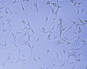 Glioblastoma İçin Hedefler ve Direnç Genleri