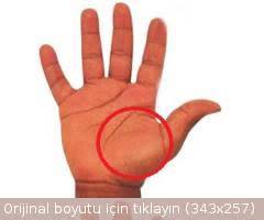 Kas Seğirmesinin Nedenleri
