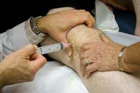 Diz Kireçlenmesinin (Osteoartrit) Evreleri ve Tedavi Şekilleri
