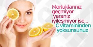 C Vitamininin Şaşırtıcı Faydaları