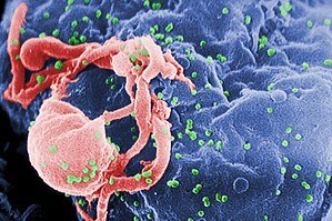 HIV Virüsünün Kökeni