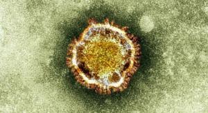 Şiddetli Akut Solunum Yetmezliği Sendromu (SARS) ve Ebola