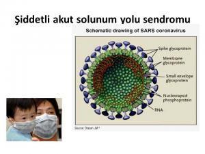 Şiddetli Akut Solunum Yetmezliği Sendromu (SARS) ve Ebola