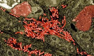 Şiddetli Akut Solunum Yetmezliği Sendromu (SARS) ve Ebola
