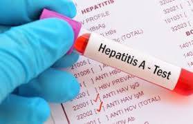 Hepatit A Nedenleri, Belirtileri ve Tedavisi