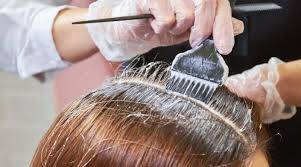 Sedef Hastalığında (Psoriasisli) Saçları Boyamak