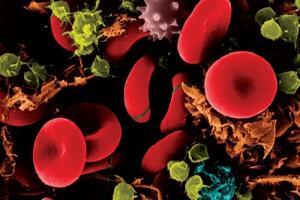Hematopoetik Kök Hücre Nakli Nedir?