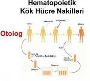 Hematopoetik Kök Hücre Nakli Nedir?