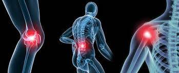 Romatoid Artrit Vücudun Hangi Bölgelerini Nasıl Etkiler?