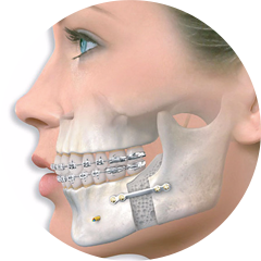 TME (Temporomandibular Eklem) Bozuklukları