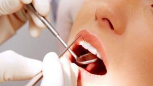 Perikoronit Nedir?