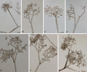 Cladosporium Nedir ve Sağlığa Etkileri Nelerdir?