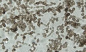 Cladosporium Nedir ve Sağlığa Etkileri Nelerdir?