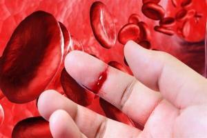 Trombositopeni Nedir?